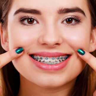 Female close up of teeth braces