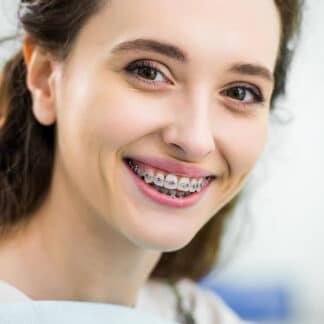 Rubber Band Wear - Orthodontist Vancouver WA, Braces and Invisalign